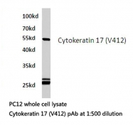 AP06198PU-N - Cytokeratin 17