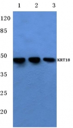 AP06199PU-N - Cytokeratin 18