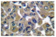 AP06204PU-N - Cytokeratin 7