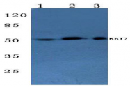 AP06204PU-N - Cytokeratin 7