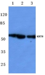 AP06205PU-N - Cytokeratin 8