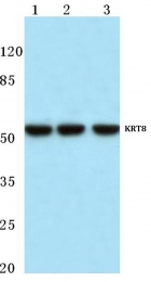 AP06206PU-N - Cytokeratin 8