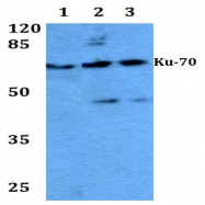 AP06207PU-N - XRCC6 / Ku70