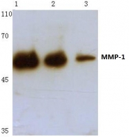 AP06224PU-N - MMP-1