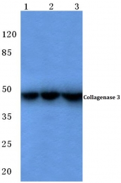 AP06226PU-N - MMP-13