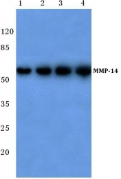 AP06227PU-N - MMP-14 / MT1-MMP