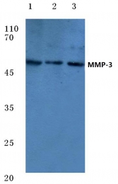 AP06233PU-N - MMP-3