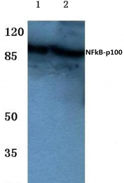 AP06241PU-N - NFKB2 / NF-kappa-B p100/p52