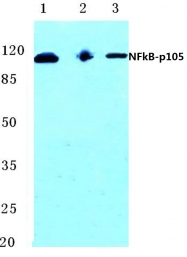 AP06244PU-N - NF-kB p105 / p50