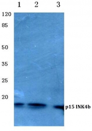 AP06261PU-N - CDKN2B / p15INK4b