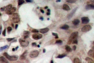 AP06274PU-N - Nibrin