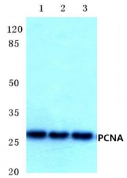 AP06281PU-N - PCNA
