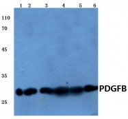 AP06282PU-N - PDGFB