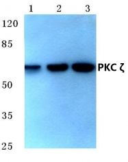 AP06286PU-N - PRKCZ