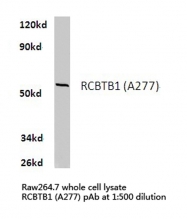 AP06305PU-N - RCBTB1