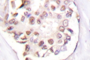 AP06308PU-N - RXR-gamma / RXRG