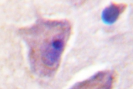 AP06314PU-N - PTPN11 / PTP2C