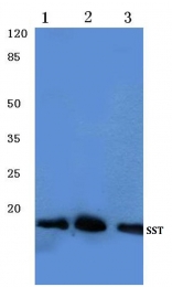AP06321PU-N - Somatostatin / SST