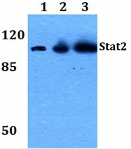 AP06326PU-N - STAT2