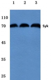 AP06336PU-N - SYK