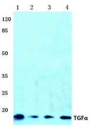 AP06348PU-N - TGF-alpha (TGFA)