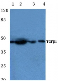AP06350PU-N - TGFB1