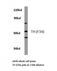 AP06358PU-N - Tyrosine 3-monooxygenase (TH)