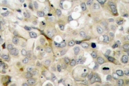 AP06362PU-N - CD309 / VEGFR-2 / Flk-1