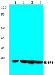 AP06365PU-N - EIF4EBP1 / 4E-BP1