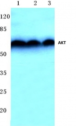 AP06368PU-N - AKT1 / PKB