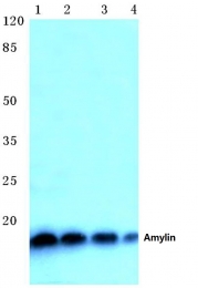AP06370PU-N - Amylin / IAPP