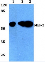 AP06372PU-N - MEF2A