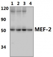 AP06372PU-N - MEF2A