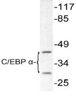 AP06373PU-N - CEBPA