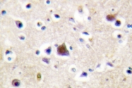 AP06390PU-N - Glucocorticoid receptor