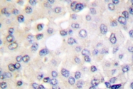 AP06397PU-N - IRS1