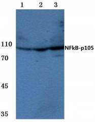 AP06402PU-N - NF-kB p105 / p50