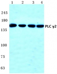 AP06406PU-N - PLCG2