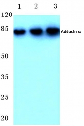 AP06423PU-N - Alpha-Adducin / ADD1