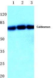 AP06424PU-N - Caldesmon