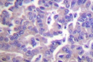 AP06424PU-N - Caldesmon