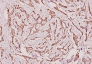 AP06425PU-N - Calnexin