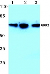AP06430PU-N - Beta-ARK-1 / ADRBK1
