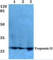 AP06439PU-N - Cardiac Troponin I