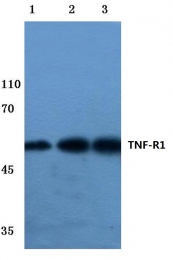AP06465PU-N - CD120a / TNFR1