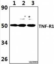 AP06465PU-N - CD120a / TNFR1