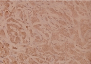 AP06465PU-N - CD120a / TNFR1