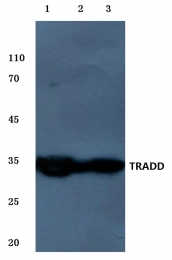 AP06467PU-N - TRADD