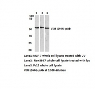 AP06478PU-N - Vimentin