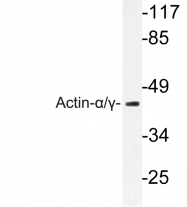 AP06487PU-N - pan Actin